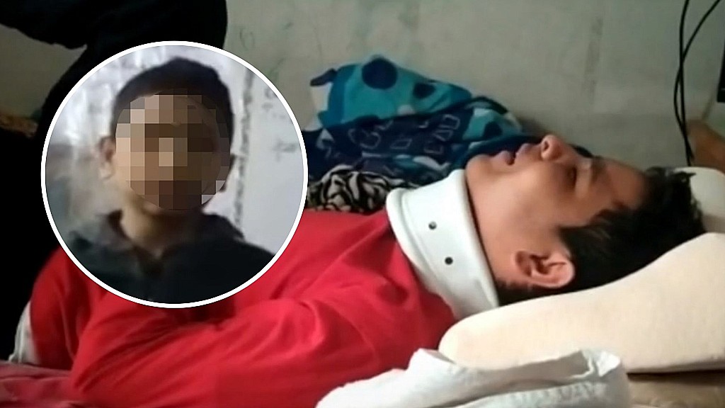 Jhoangel Jesus Zambrano, un niño venezolano de 11 años sufrió una brutal golpiza que le provocó un derrame cerebral